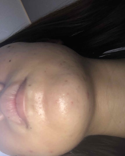敏感肌用薬用美白美容液/無印良品/美容液を使ったクチコミ(3枚目)