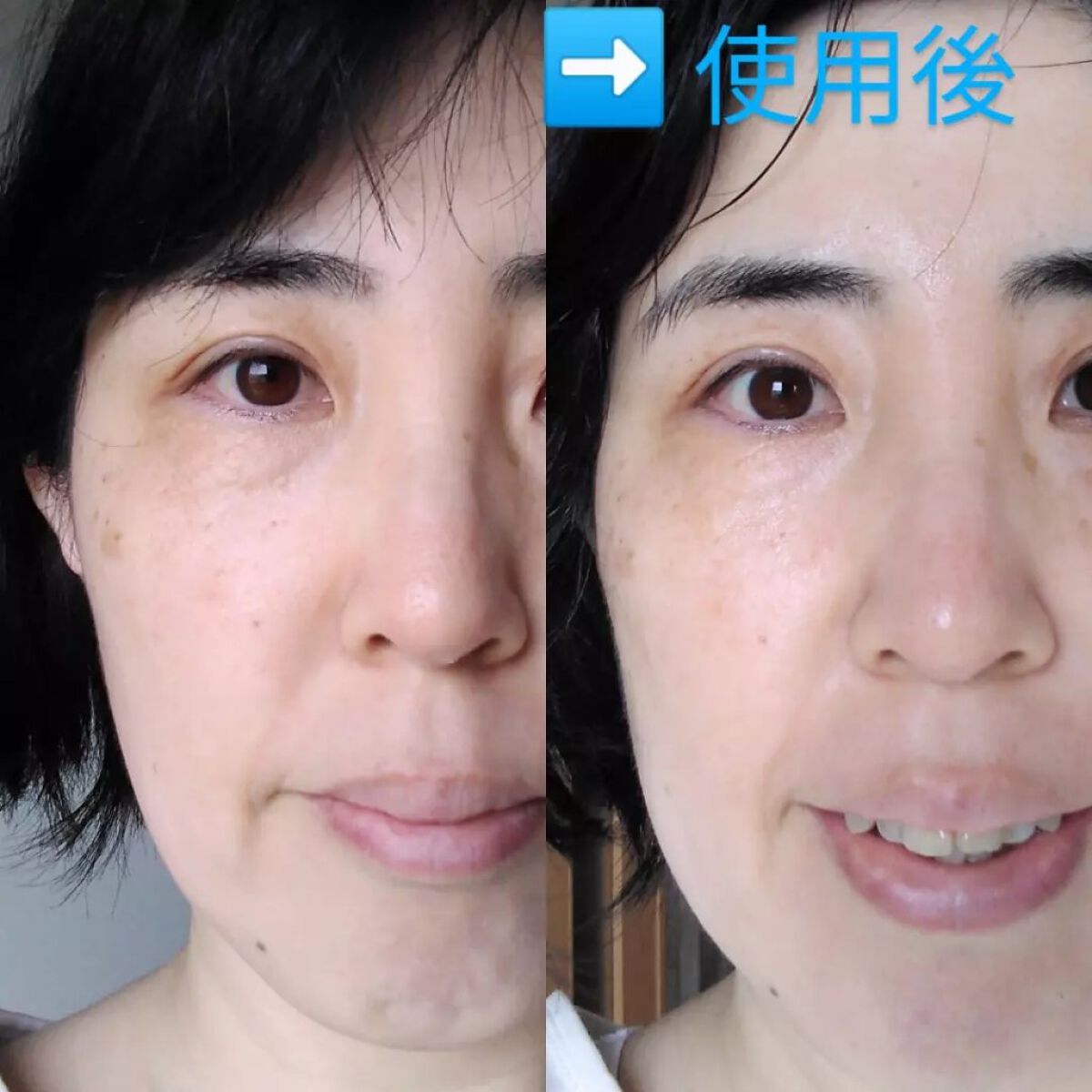 青汁フェイスマスク/青汁化粧品/シートマスク・パックを使ったクチコミ(6枚目)