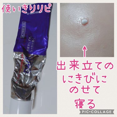 ペアアクネクリームW(医薬品)/ペア/その他スキンケアグッズを使ったクチコミ（1枚目）