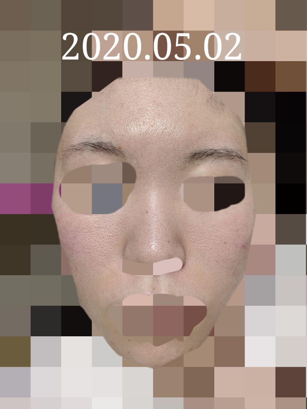 エバレッシュホワイトEXⅡ(医薬品)/matsukiyo/その他を使ったクチコミ（1枚目）