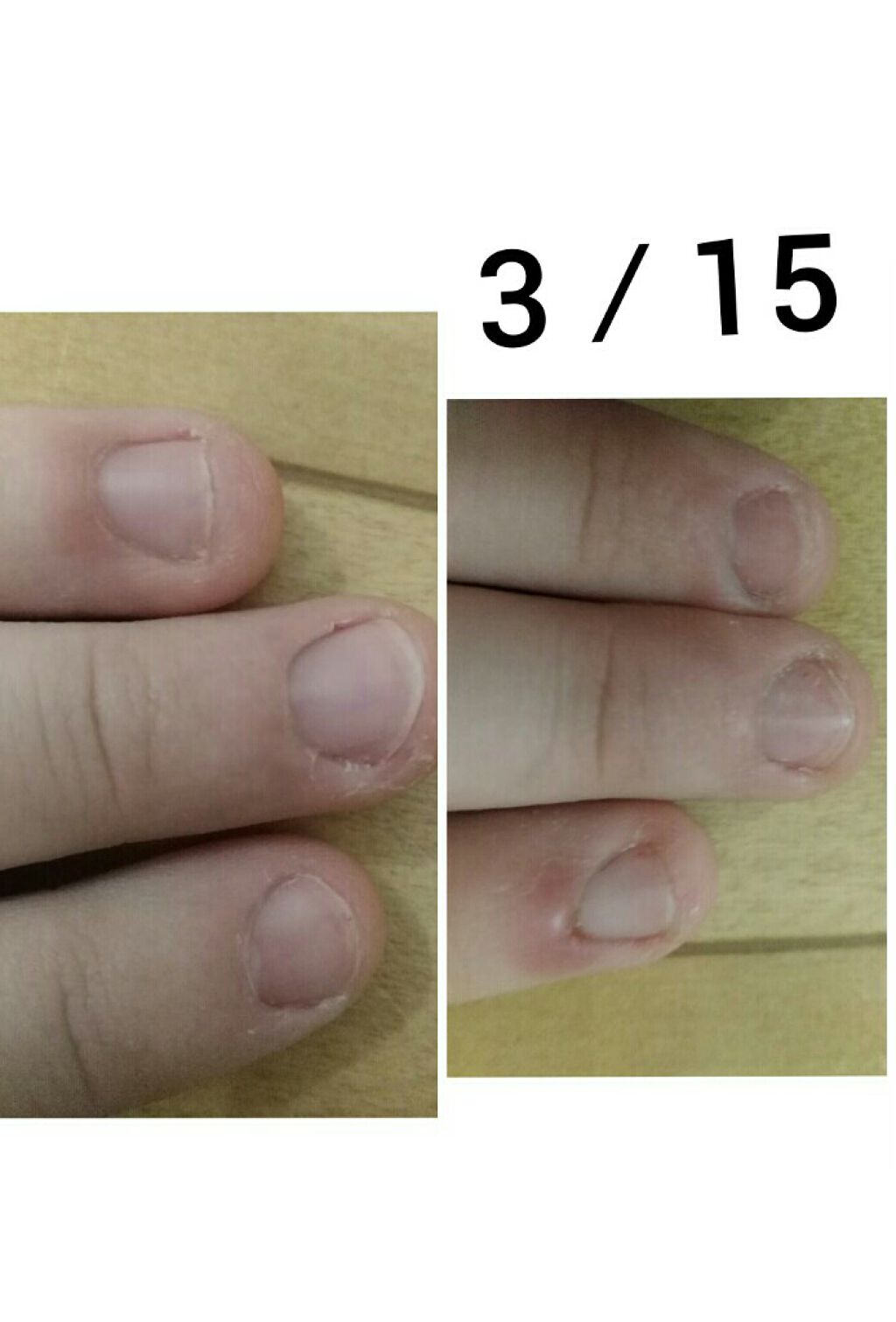 オリジナル ピュアスキンジェリー/ヴァセリン/ボディクリームを使ったクチコミ(3枚目)