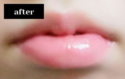 ハニーフルリップ R/カントリー&ストリーム/リップ美容液を使ったクチコミ(5枚目)