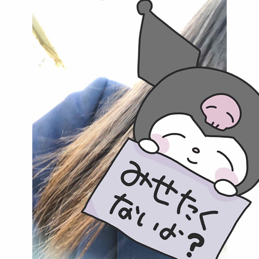 オキシドール(医薬品)/日本薬局方/その他を使ったクチコミ(1枚目)