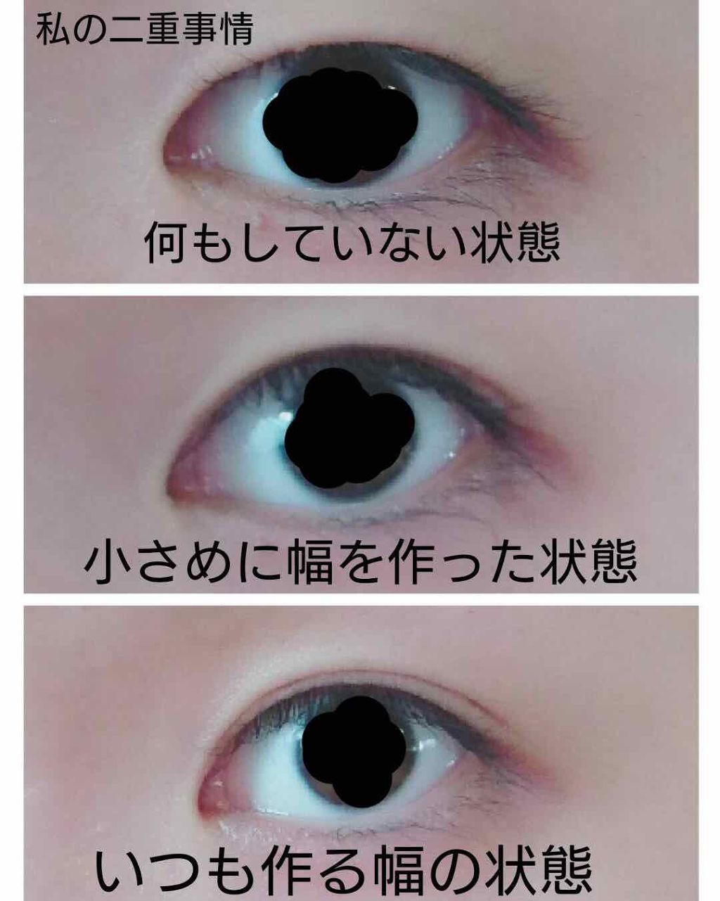 のびーるアイテープ（絆創膏タイプ、レギュラー）/DAISO/二重まぶた用アイテムを使ったクチコミ（1枚目）