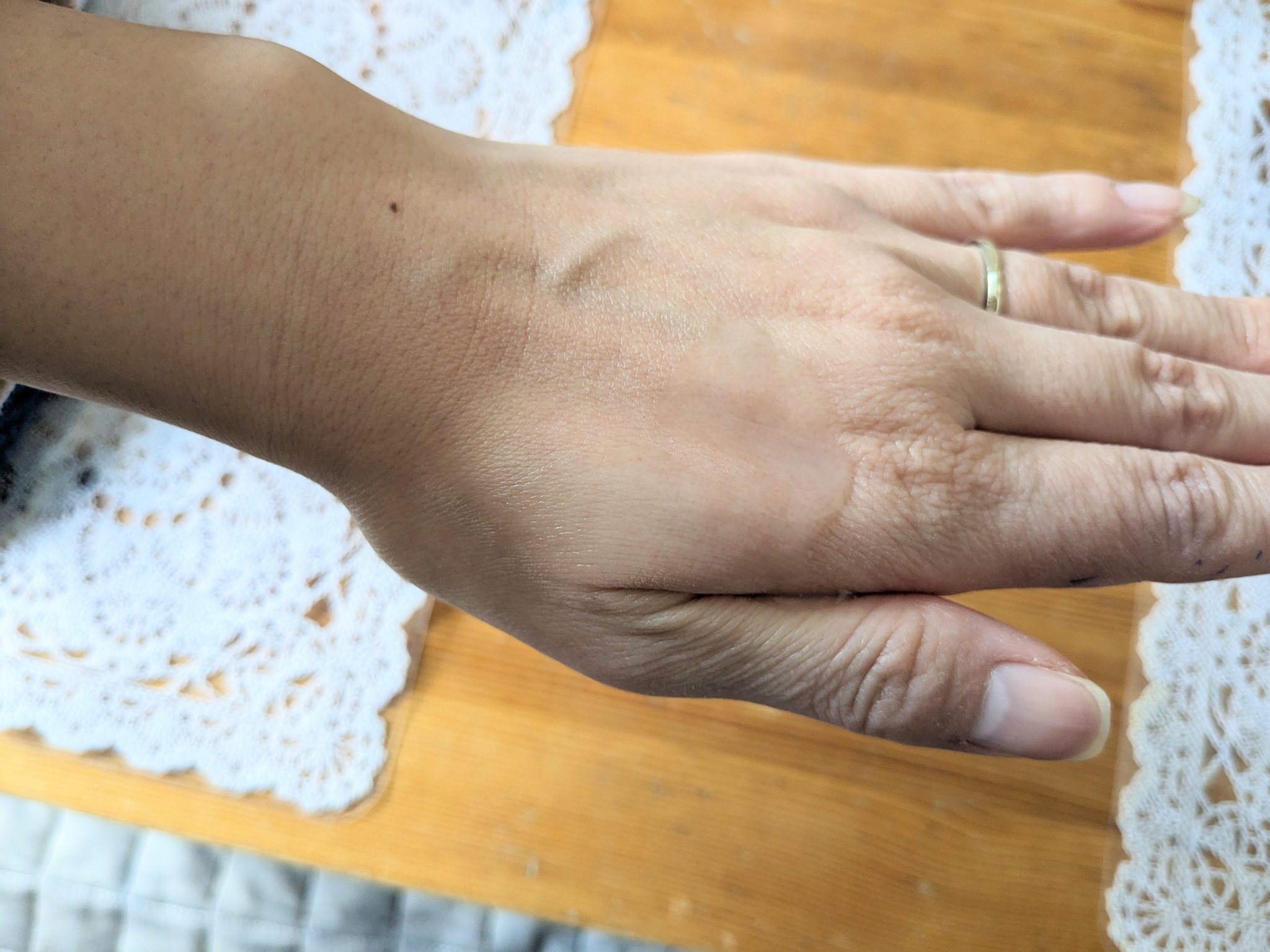 グルタチオンアンプルトナー/SKIN&LAB/化粧水を使ったクチコミ（2枚目）