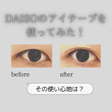 ふたえテープ 目立たず肌になじむ絆創膏タイプ/DAISO/二重まぶた用アイテムを使ったクチコミ（1枚目）