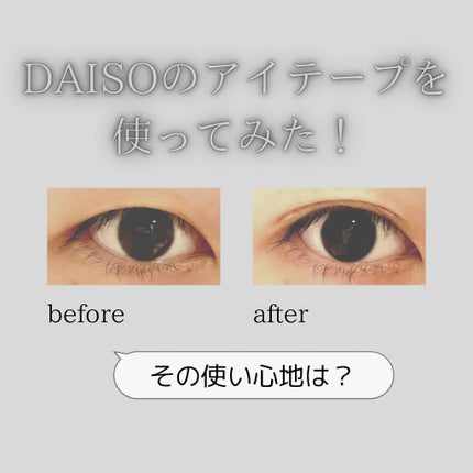 ふたえテープ 目立たず肌になじむ絆創膏タイプ/DAISO/二重まぶた用アイテムを使ったクチコミ(1枚目)