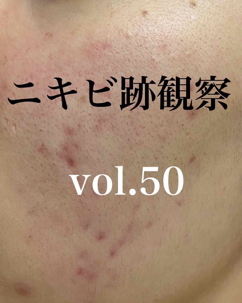 ハトムギ洗顔フォーム/株式会社イヴ/洗顔フォームを使ったクチコミ（1枚目）