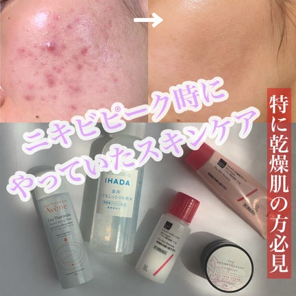 ウオーター/アベンヌ/ミスト状化粧水を使ったクチコミ(1枚目)