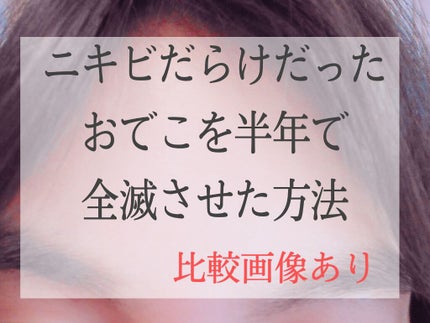 明色美顔水 薬用化粧水/美顔/化粧水を使ったクチコミ(1枚目)