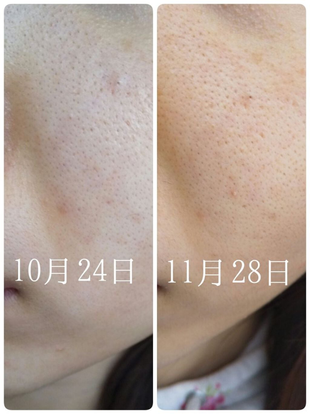 パワーマスク SP/ラッシュ/スクラブ・ゴマージュを使ったクチコミ(2枚目)