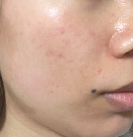 ヘルプミー! ダクトパッド/One-day's you/トナーパッドを使ったクチコミ(6枚目)