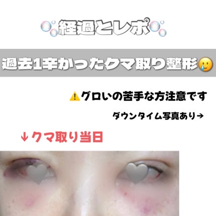 を使ったクチコミ(1枚目)