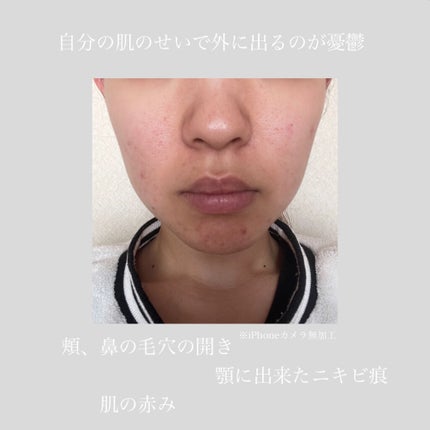 美白化粧水 VC/ちふれ/化粧水を使ったクチコミ(2枚目)
