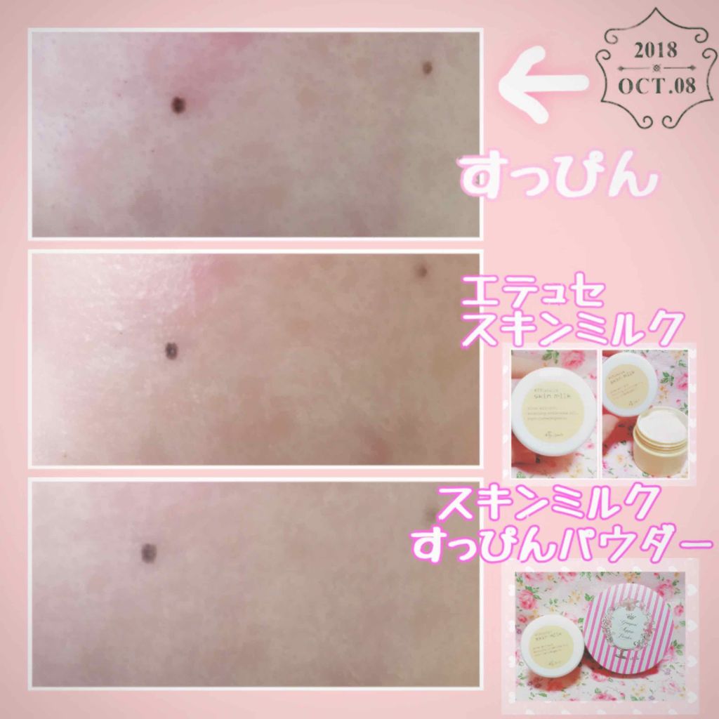 スキンミルク/ettusais/フェイスクリームを使ったクチコミ（3枚目）