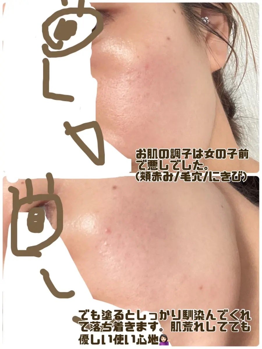 バイタルエナジー ホワイトニングエッセンスCプラス/メイコー化粧品/美容液を使ったクチコミ(4枚目)