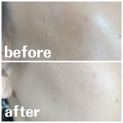 トーンアップフェイスパウダー/Kirei&co./プレストパウダーを使ったクチコミ(3枚目)