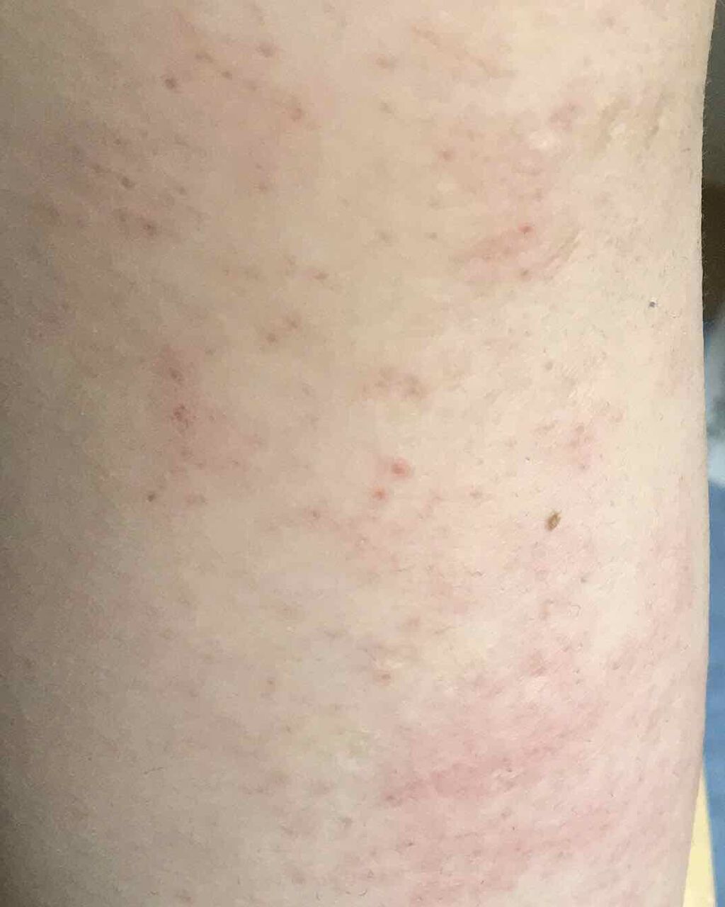 除毛クリームキット敏感肌用/エピラット/除毛クリームを使ったクチコミ(3枚目)