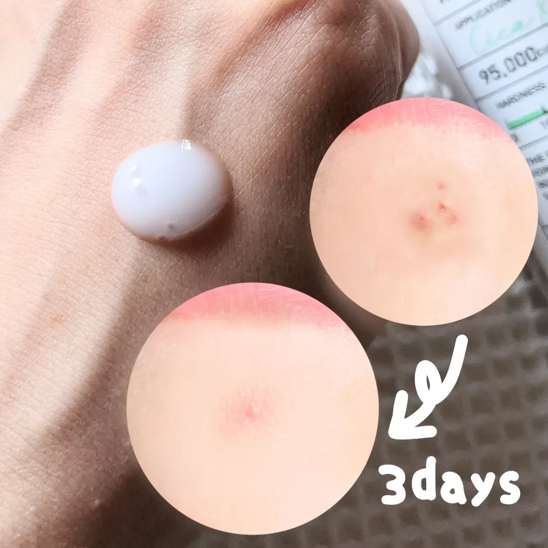 リードルショット100/VT/美容液を使ったクチコミ（3枚目）