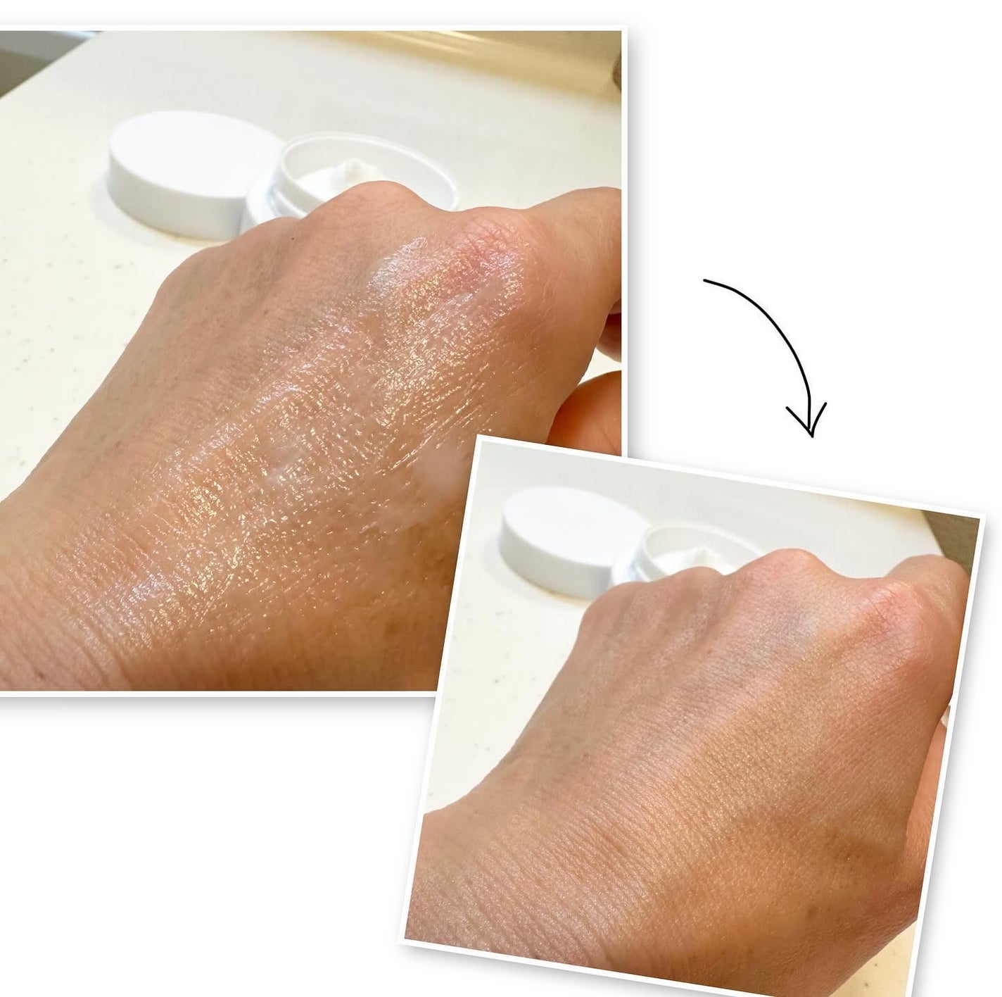 fuzukiフォロバ♡ on LIPS 「ついにシリーズ第6弾♡ニキピタのアゼライン酸高濃度配合ライン「..」(5枚目)