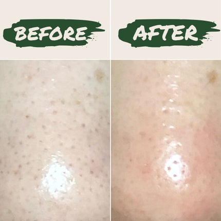 MC クレンジングジェル/HONO/クレンジングジェルを使ったクチコミ(3枚目)