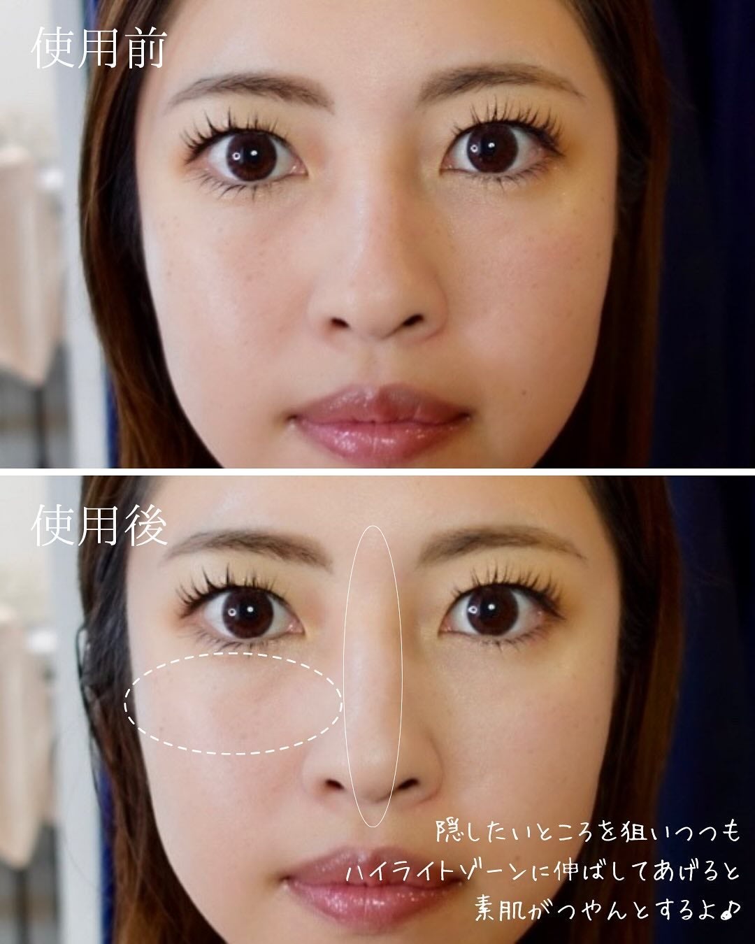 ダーマシンコンシーラー/23years old/リキッドコンシーラーを使ったクチコミ(4枚目)