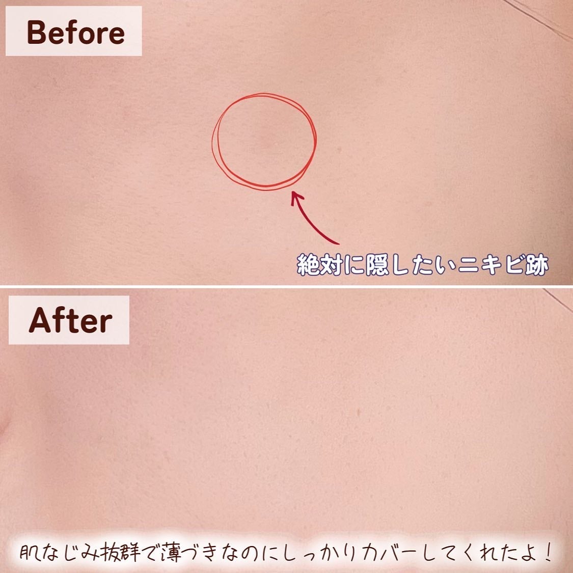 イプノス シーバムクリア リペアクリーム/ACSEINE/フェイスクリームを使ったクチコミ(5枚目)