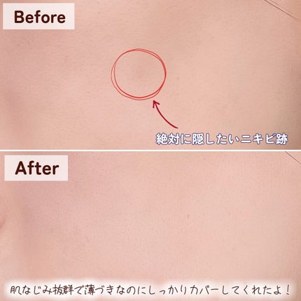 イプノス シーバムクリア リペアクリーム/ACSEINE/フェイスクリームを使ったクチコミ(5枚目)