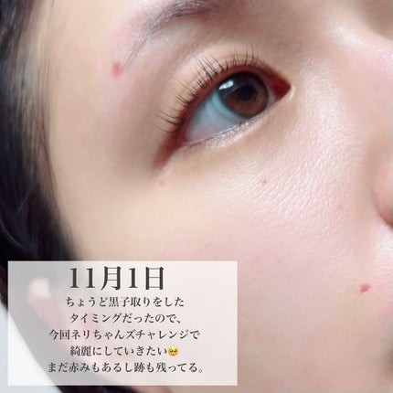 キューブマスク レチノール/ネイチャーリパブリック/シートマスク・パックを使ったクチコミ(4枚目)