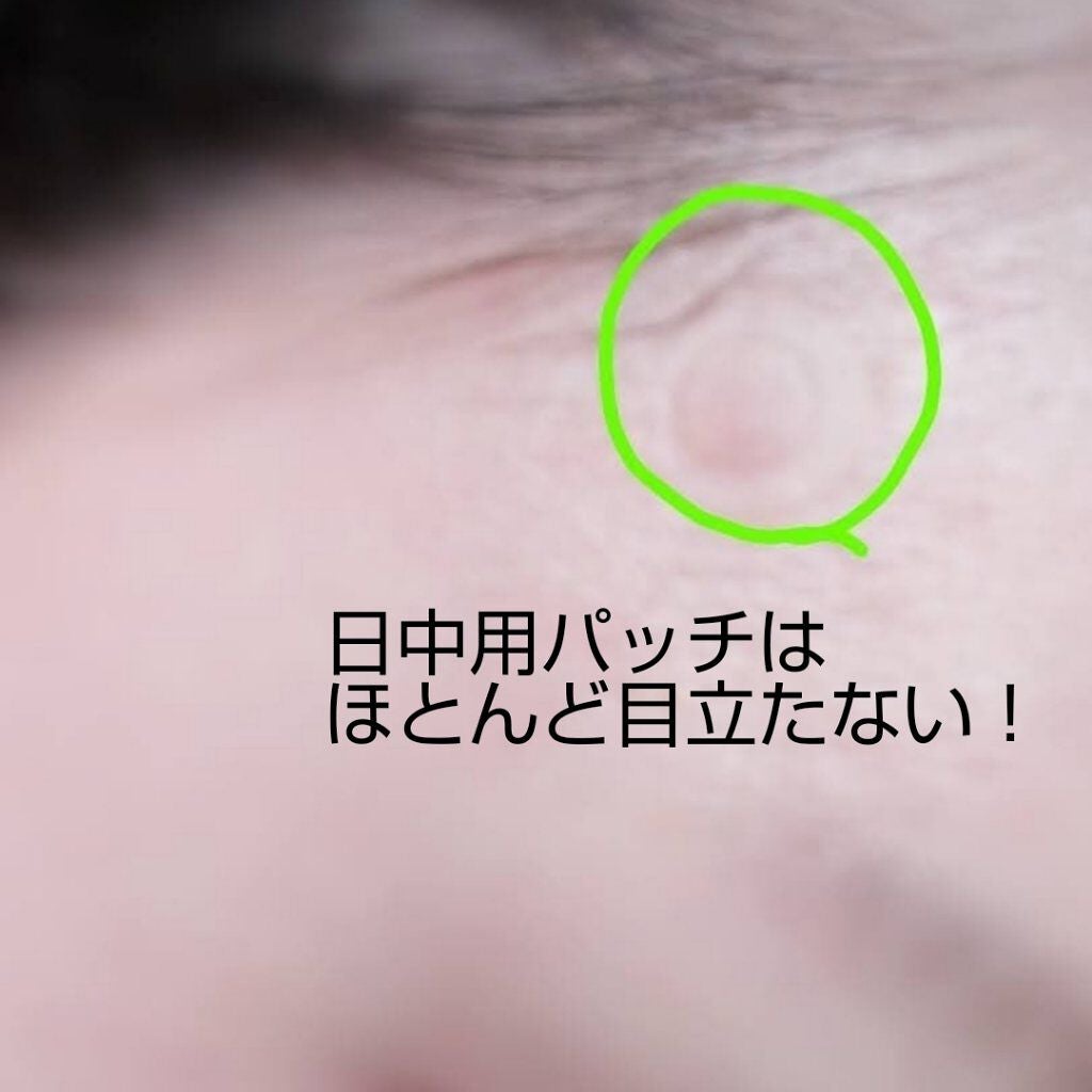 ACケアプラス/ACROPASS/その他キットセットを使ったクチコミ(4枚目)