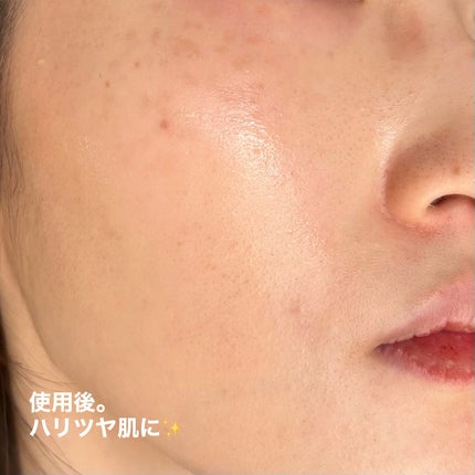 シークレットくすみセラム/Aetem /美容液を使ったクチコミ(5枚目)