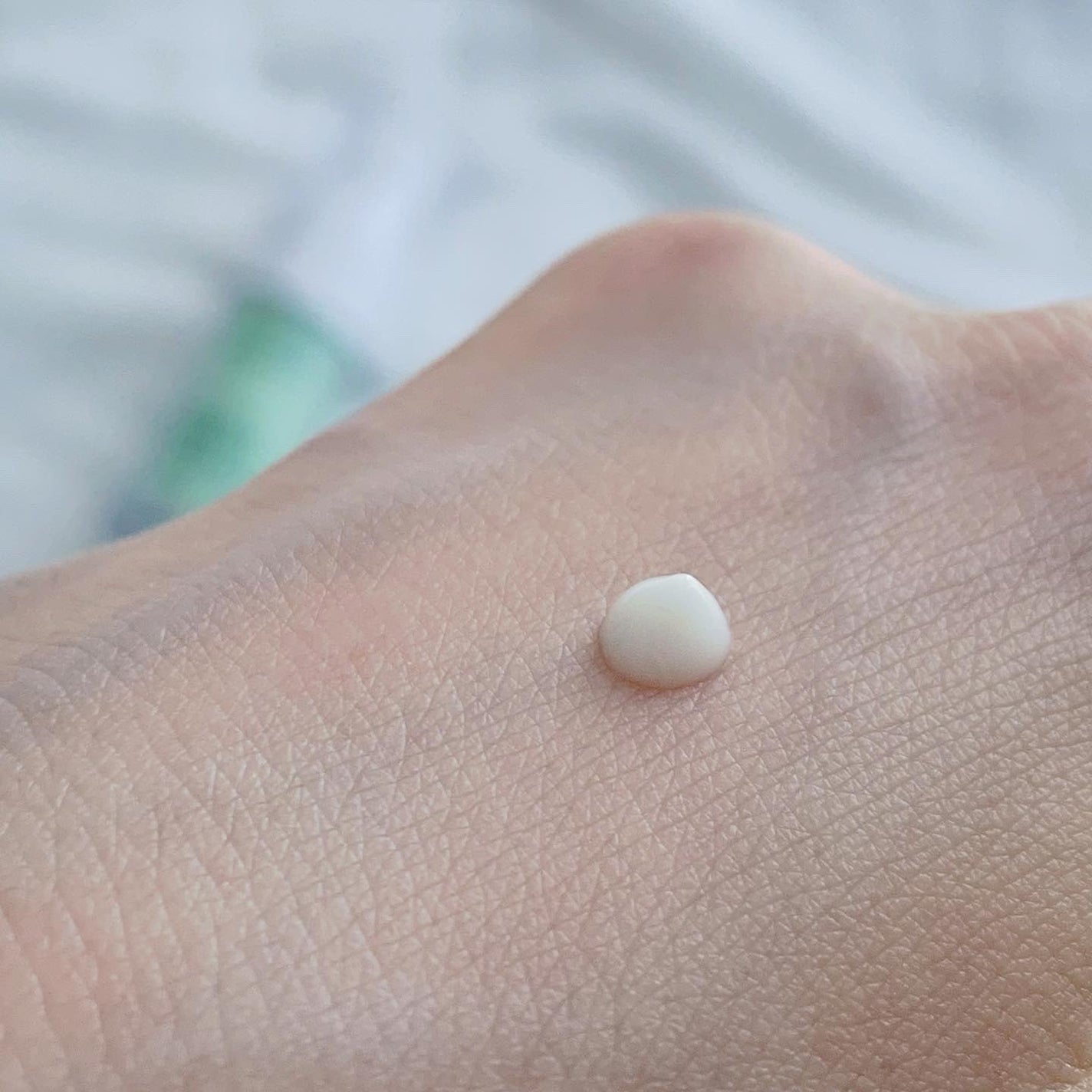 シカレチA エッセンス0.1/VT/美容液を使ったクチコミ(3枚目)