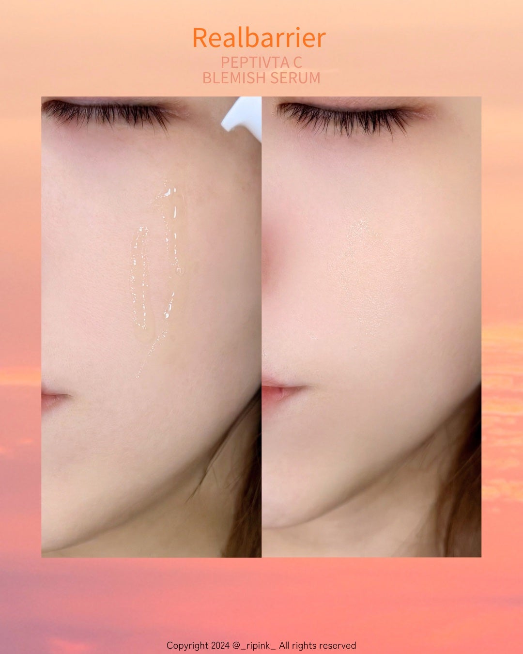 レチ二オールポアタイトニングセラム/Real Barrier/美容液を使ったクチコミ(6枚目)