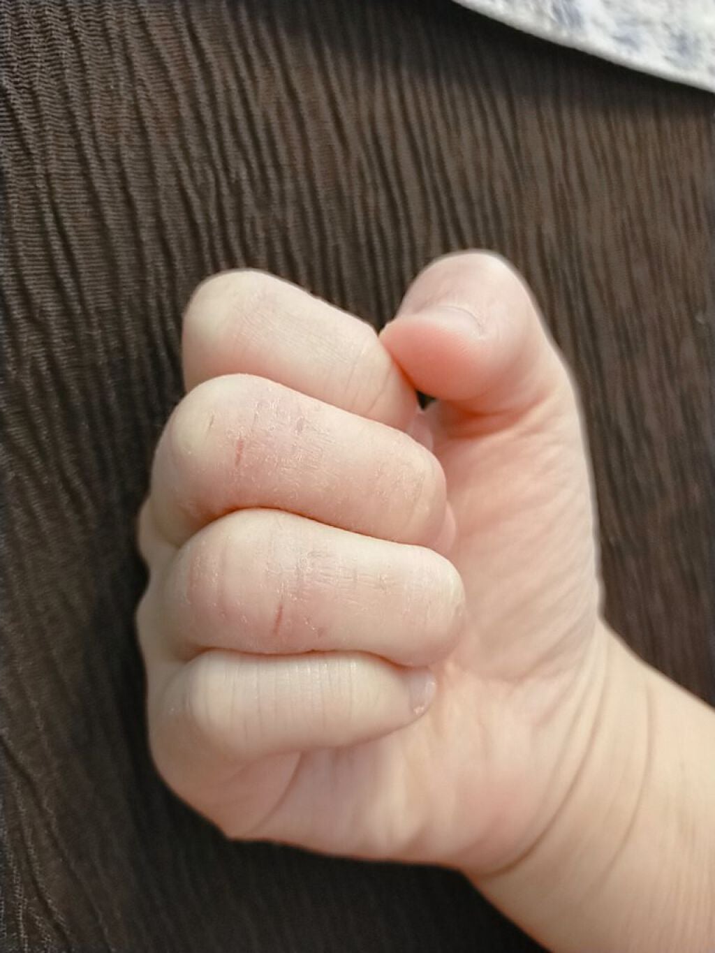 ヒビケア軟膏 (医薬品)/ムヒ/その他を使ったクチコミ(5枚目)