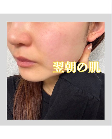 スーパーナイツ ビタミンマスク/belif/フェイスクリームを使ったクチコミ(4枚目)