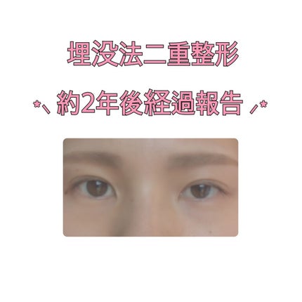 tsuki on LIPS 「前回の投稿にいいねしてくださる方が未だにいて「あ、経過報告して..」(1枚目)