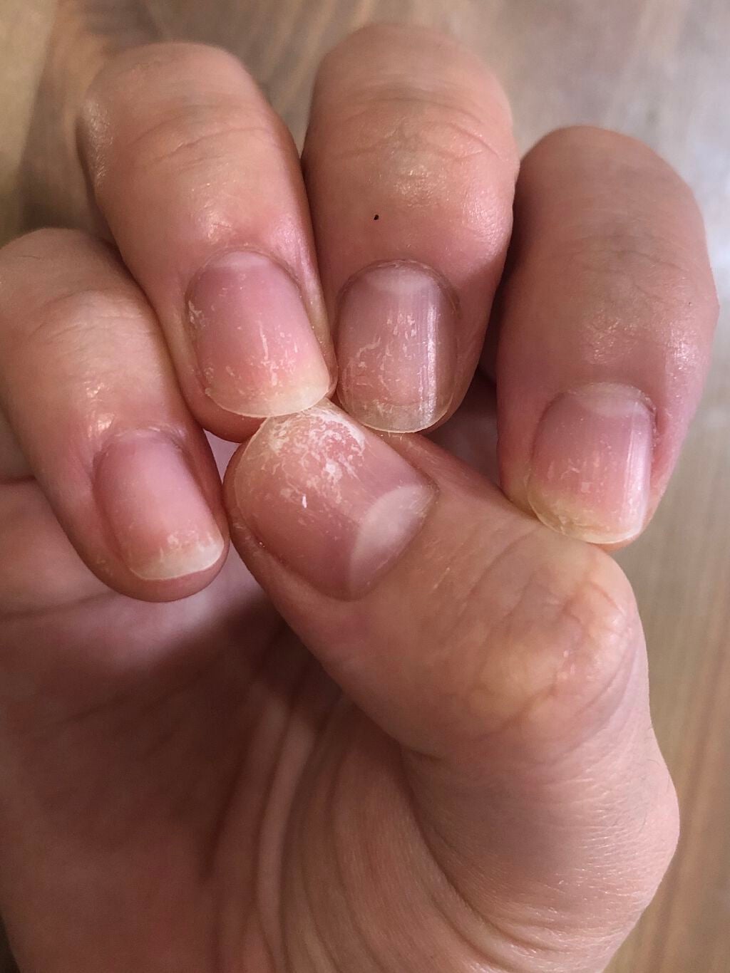 akðŒ on LIPS ãohoraåŸã®çªãçµæ§æã£ãŠããããðŠç¹ã«èŠªæâŠãçªè¡šé¢ãã¯ã..ãïŒ1æç®ïŒ