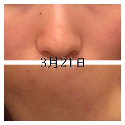 化粧水・敏感肌用・しっとりタイプ/無印良品/化粧水を使ったクチコミ(4枚目)