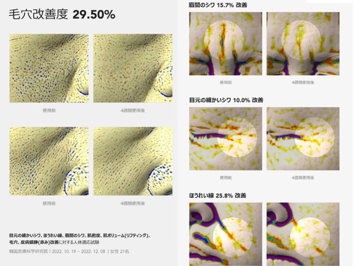 ヴィーガンリポソームレチノールセラム/SKIN&LAB/美容液を使ったクチコミ(3枚目)