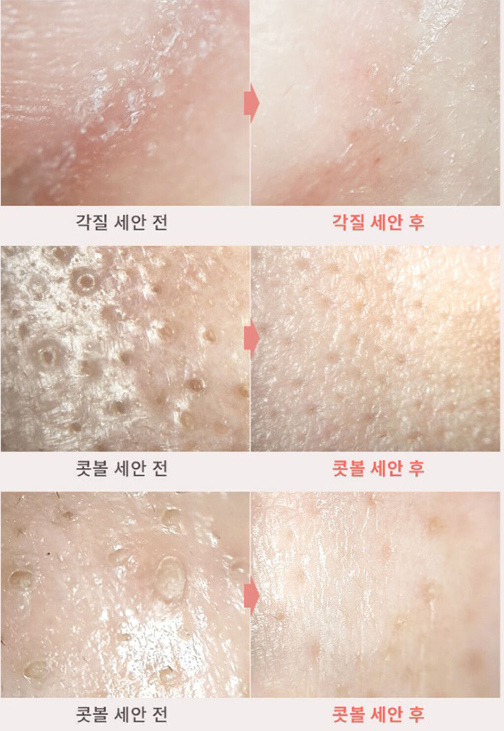 グレープフルーツ弱酸性マイルドPHAジェルクレンザー/Hope Girl/クレンジングジェルを使ったクチコミ（3枚目）