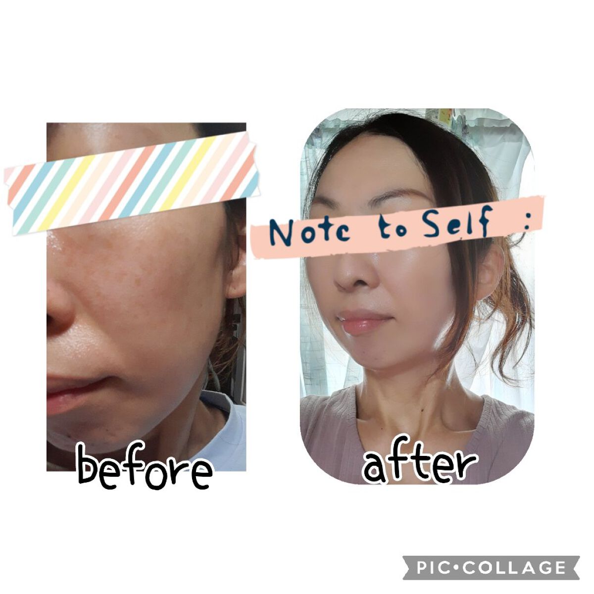 ルミシーラーモイスチャー ロゼ/N＆ｍ/クリームコンシーラーを使ったクチコミ（1枚目）