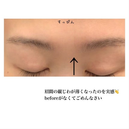 エリクシール シュペリエル エンリッチド リンクルクリーム/エリクシール/アイケア・アイクリームを使ったクチコミ(3枚目)