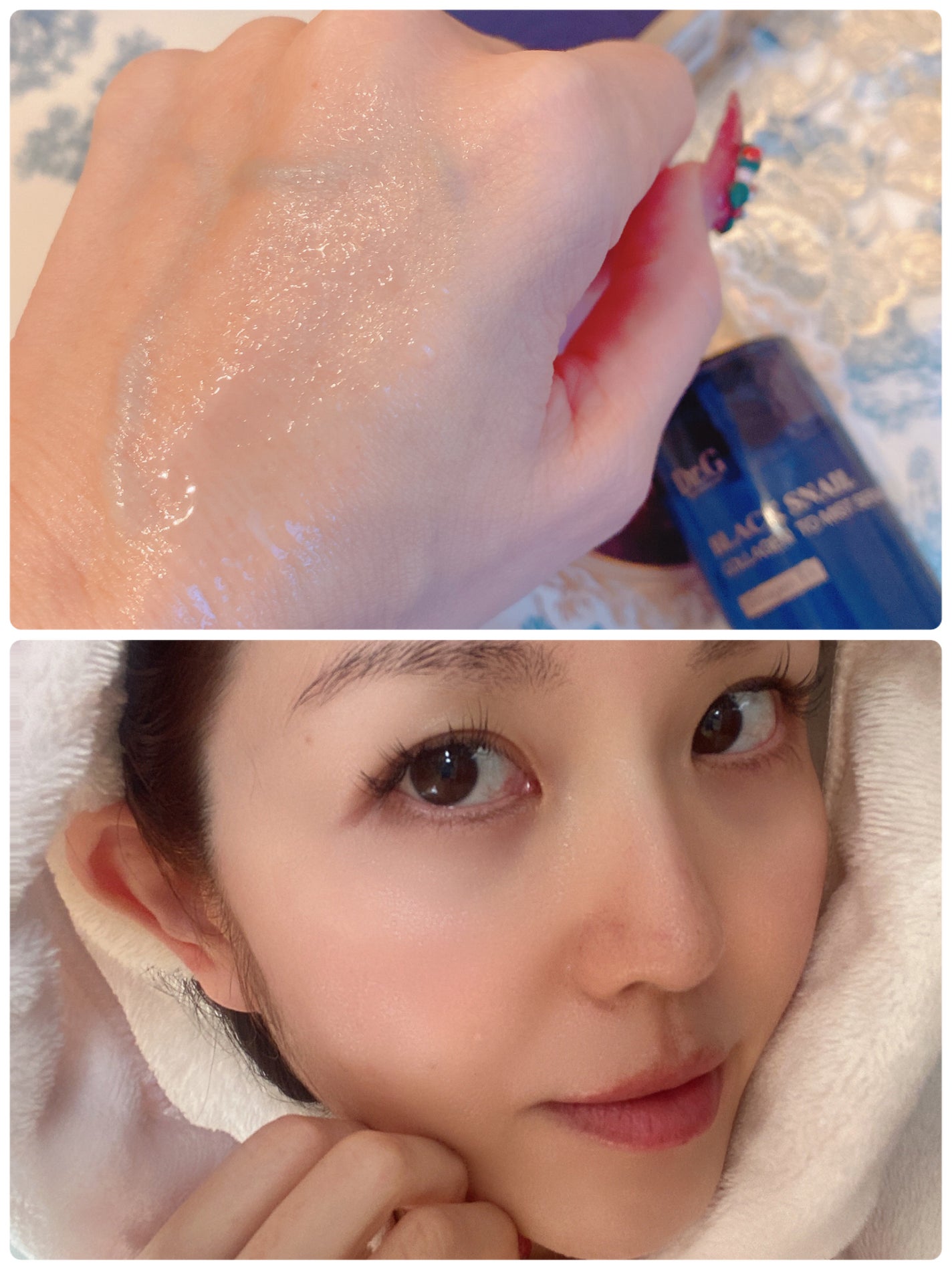 ドクタージー ブラックスネイル コラーゲンミスト/Dr.G/ミスト状化粧水を使ったクチコミ(4枚目)