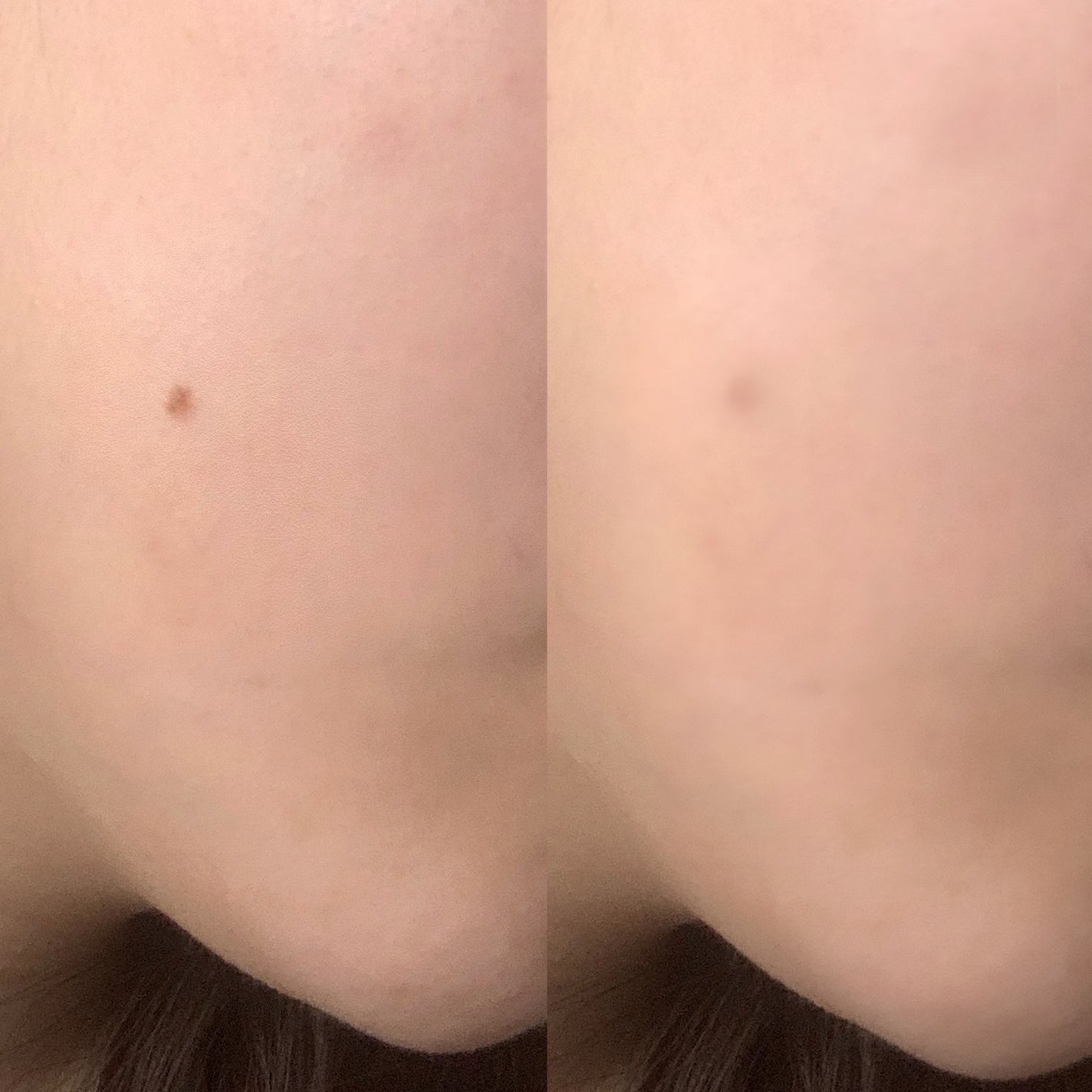 アイレノールすっぴんクリーム/IRENOL/クリームコンシーラーを使ったクチコミ(4枚目)