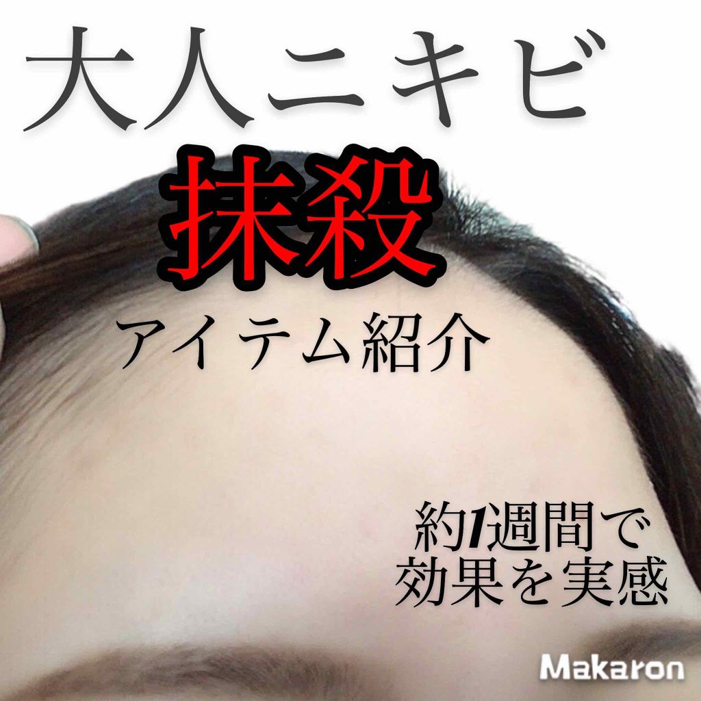 ペアアクネクリームW(医薬品)/ペア/その他を使ったクチコミ（1枚目）