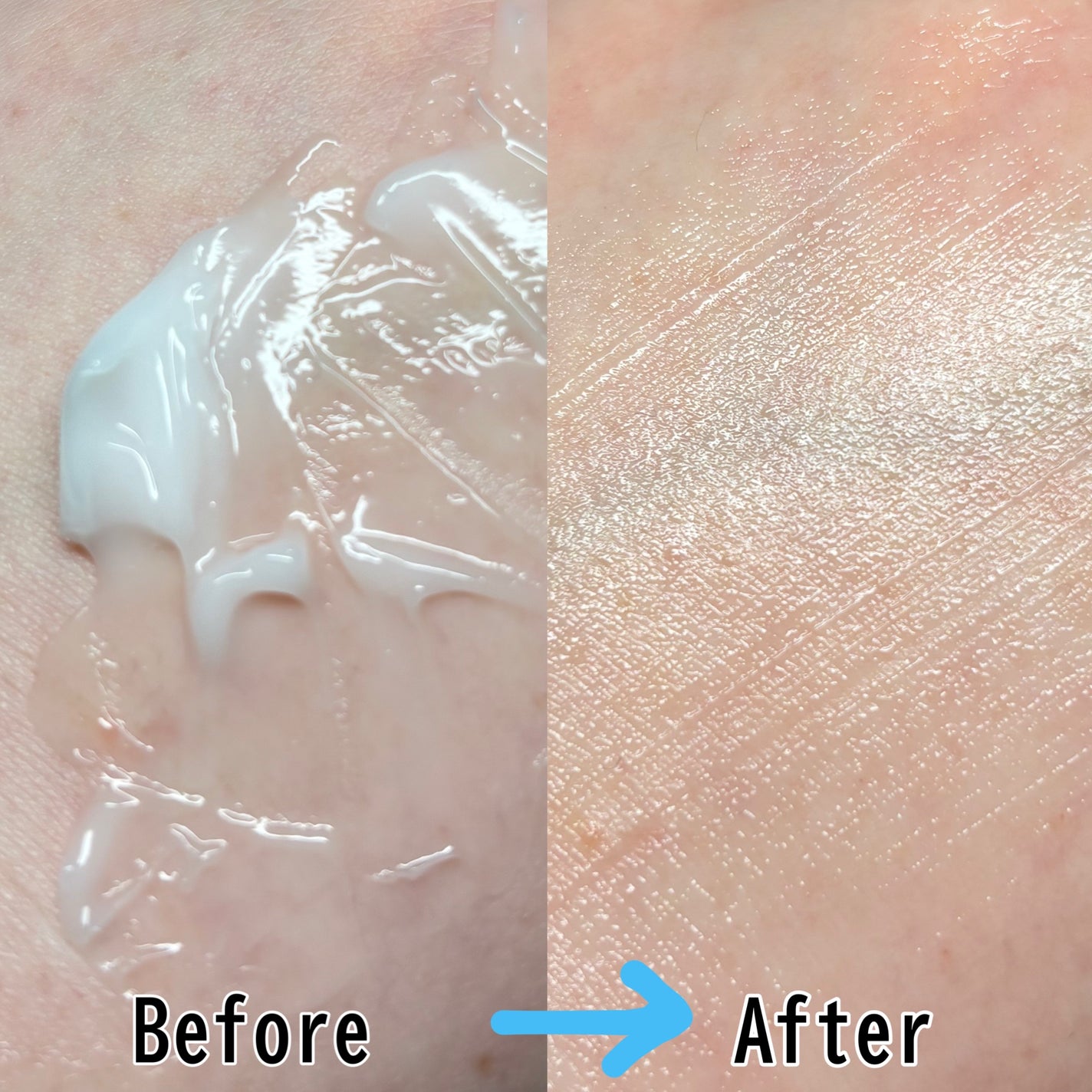 レッドブレミッシュ クリアモイスチャークリーム/Dr.G/フェイスクリームを使ったクチコミ(2枚目)