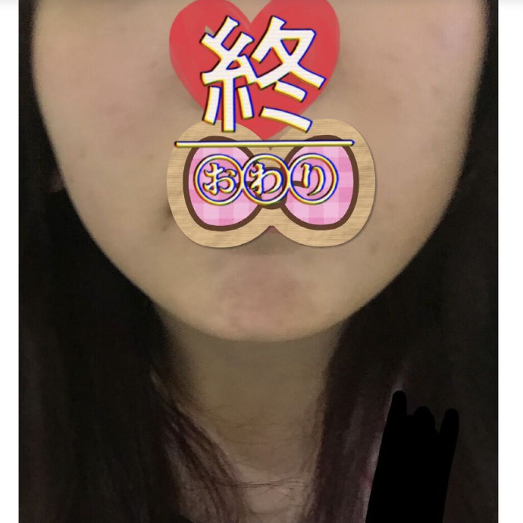 浄水シャワー(シャモジーW)/ニトリ/シャワーヘッドを使ったクチコミ（2枚目）