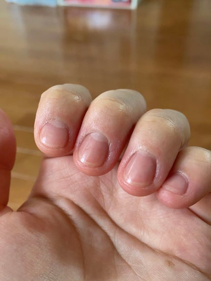 クイッククリスタルコートⅡ/ネイリスト/ネイルトップコートを使ったクチコミ(7枚目)