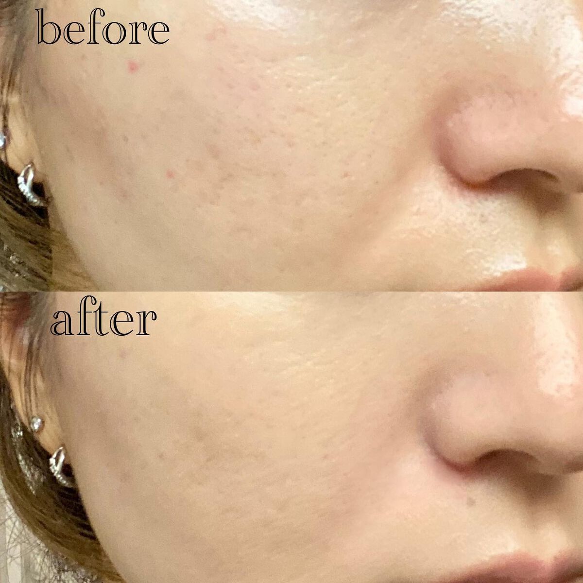 (旧)アンリミテッド ラスティング フルイド/shu uemura/リキッドファンデーションを使ったクチコミ(5枚目)