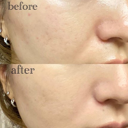 (旧)アンリミテッド ラスティング フルイド/shu uemura/リキッドファンデーションを使ったクチコミ(5枚目)